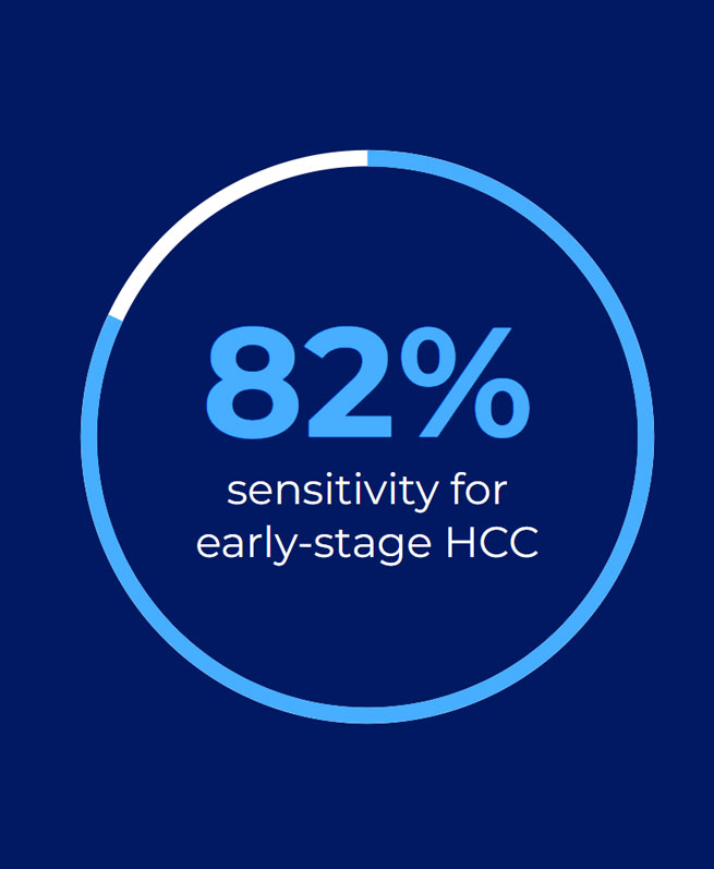 Statistic displaying that Oncoguard® Liver has 82% sensitivity for early-stage HCC.